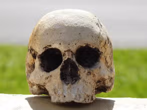 Bones & Bodies: Fun Skeletal Quiz for Kids